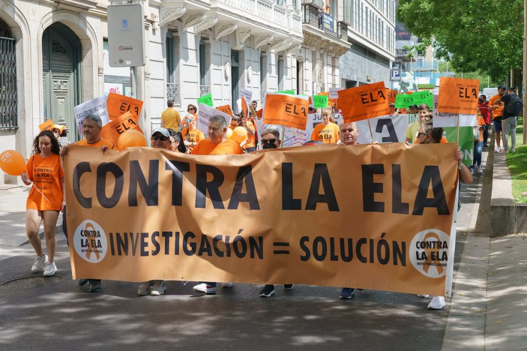 Un gran consorcio científico español investigará los enigmas moleculares de la ELA