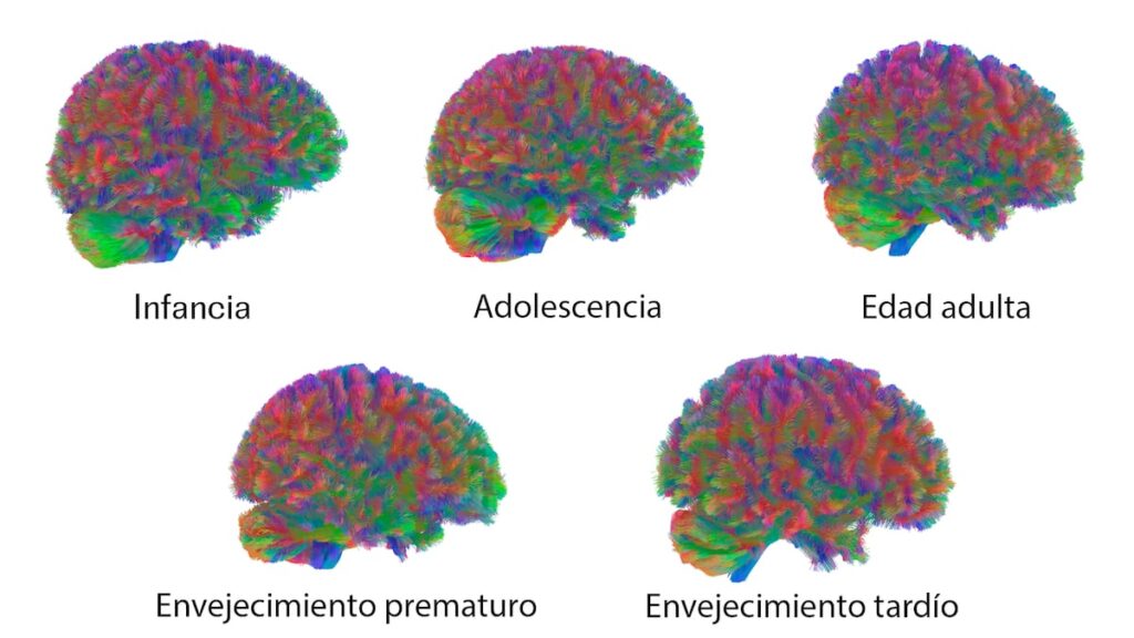 Las cinco ‘edades’ del cerebro humano: hay cambios cruciales alrededor de los 9, los 32, los 66 y los 83 años | Salud y bienestar