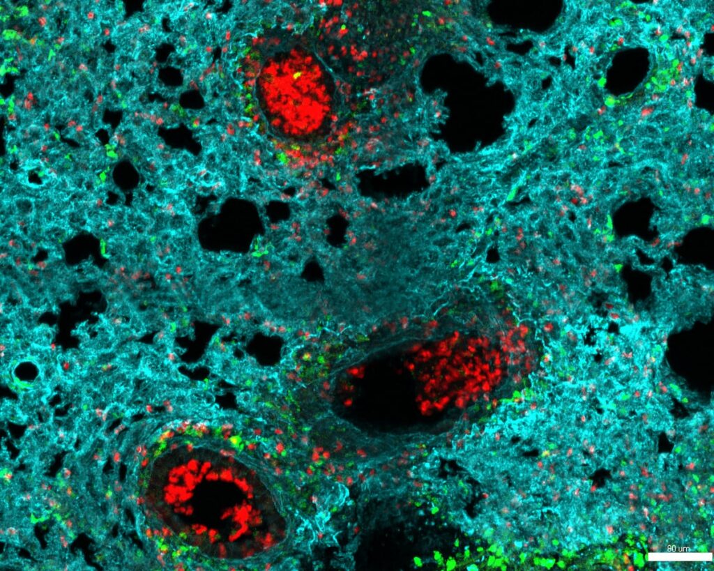 El mapa de los neutrófilos: crean una herramienta para combatir el cáncer o las infecciones con las células inmunes más abundantes