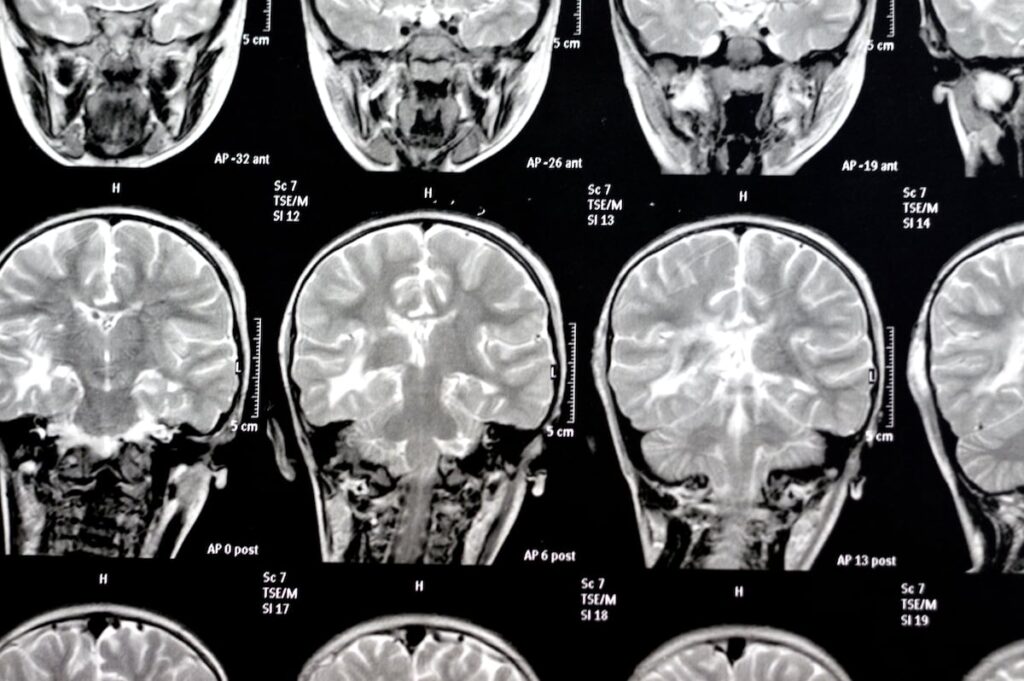 De Borges a Jennifer Aniston: la ciencia empieza a iluminar los misterios de la memoria