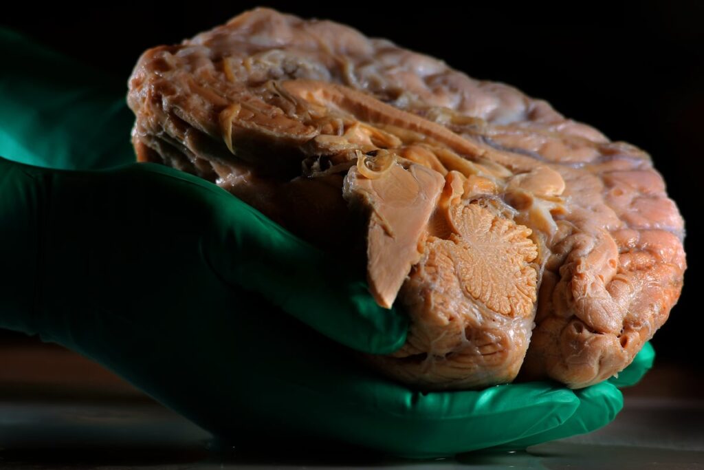 ¿Lo dejas todo para luego? Unos científicos japoneses han encontrado el motivo en el cerebro | Ciencia