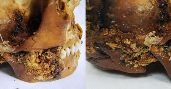 Descubren una cirugía maxilofacial en un cráneo de hace 2.500 años