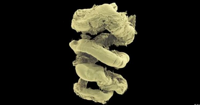 Lanzan el “Google Earth” del cuerpo humano gratis: es 100 mil millones de veces mejor que radiografías | Ciencia y Tecnología