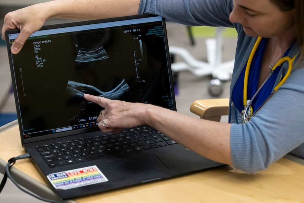 Reconocerse en un testimonio de internet ante el infradiagnóstico del síndrome de ovario poliquístico | Salud y bienestar