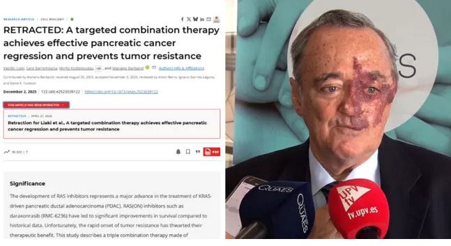 Vuelven a publicar polémico estudio sobre posible “cura” para cáncer de páncreas