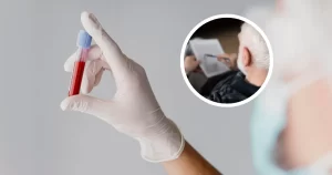 Los 4 análisis de sangre que ayudan a detectar el Alzheimer en EEUU: ¿están en Chile? | Salud y Bienestar